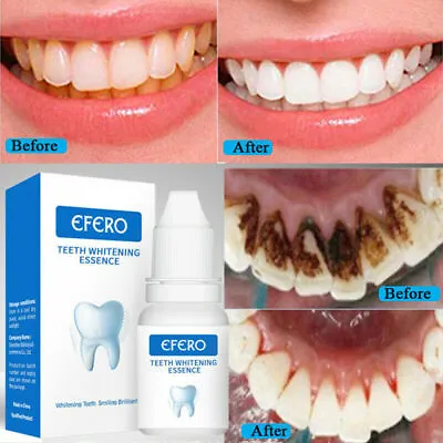 New Instant Tooth Whitening Kit White Teeth Clean Gel Uv Bleach Dental Strength • $14.45