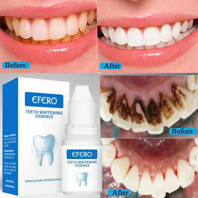$14.45 • Buy New Instant Tooth Whitening Kit White Teeth Clean Gel Uv Bleach Dental Strength