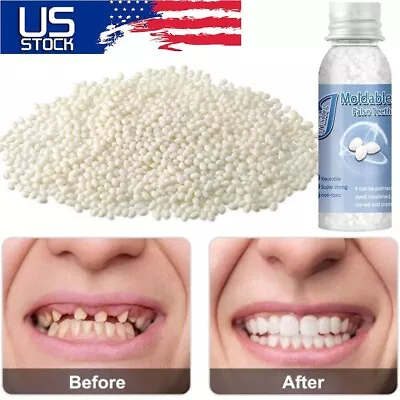Resin False Teeth Solid Glue Temporary Tooth Repair Moldable Fix Broke Gap Teeth • $7.63