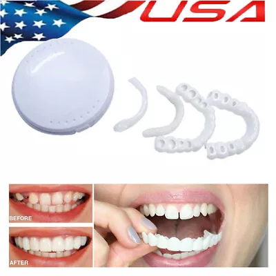 Smile Snap On Upper＆Bottom Set False Teeth Dental Veneers Denture Tooth Cover🔥 • $4.55