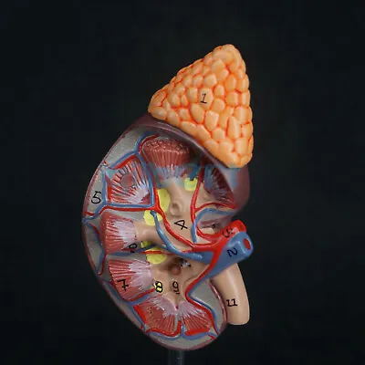 1:1 Human Kidney With Adrenal Gland Anatomical Medical Model Urology Anatomy D01 • $22.77