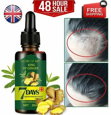 £6.99 • Buy Ginger Fast Hair Growth Loss Serum Essential Oil Anti Preventing Hair Loose 🔥✅