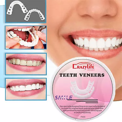 Snap On Pair Upper And Lower Smile Cosmetic Dental White Teeth Denture Veneers • $6.80