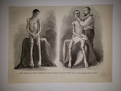 Rebel Cruelty General Hospital Annapolis MD Civil War 1864 Sketch Print RARE! • $19.99