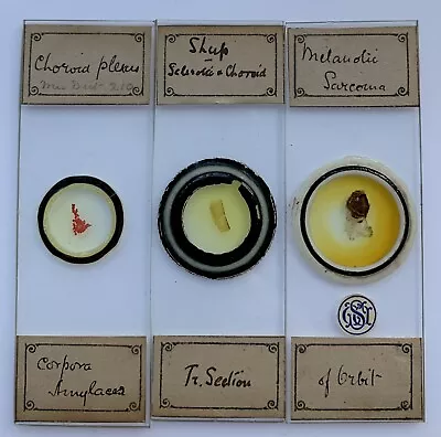 Three Antique Microscope Slides Of Human Eye Sections. Monogram • $18.65