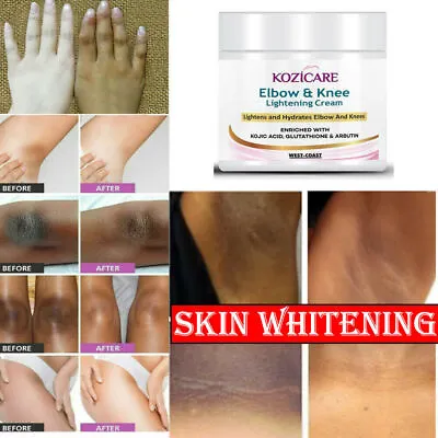 $27.03 • Buy Dark Skin Whitening Cream Armpit Underarm Body Bleaching Lightening Brightening