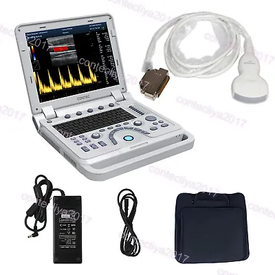 CONTEC Digital Color Ultrasound Scanner Laptop Machine With 3.5mhz Convex Probe • £3337