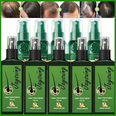 £23.95 • Buy 120ml Hair Growth Spray Hair Growth Spray For Men Women Hair Regrowth Treatment