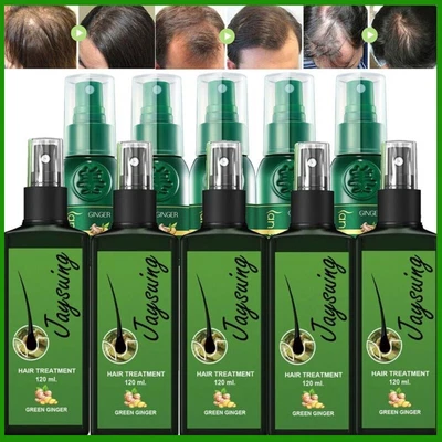 £23.95 • Buy 120ml Hair Growth Spray Hair Growth Spray For Men Women Hair Regrowth Treatment