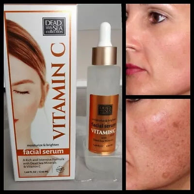 £5.99 • Buy Vitamin C Anti-Aging Face Serum Spots Removal And Anti Ageing Skin Glowing Serum