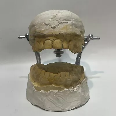 Vintage DENTAL TEETH PLASTER CAST MEDICAL ODDITY Dentist TEETH TOOTH IMPRESSION • $75