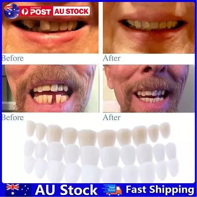 $7.21 • Buy Silicone Simulated Tooth Cover Teeth Whitening Denture Paste Instant Smile AU