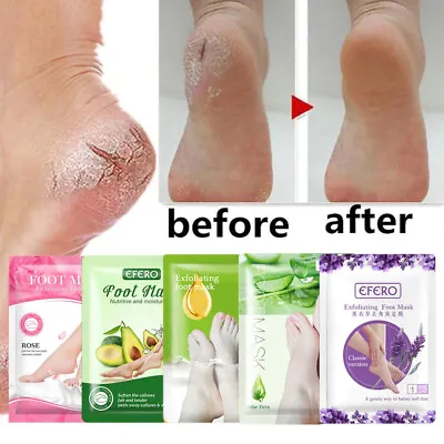 Exfoliating Foot Mask Peel Off Foot Sock Soft Baby Feet Removes Dead Skin Callus • £4.94