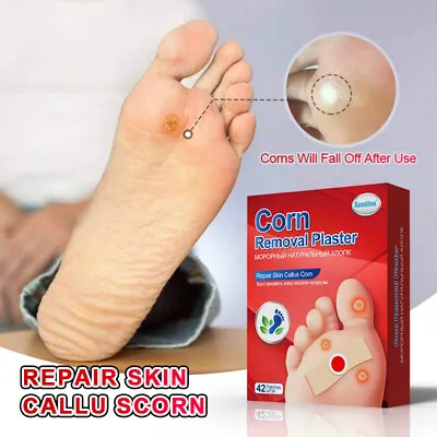 42 Pcs Foot Corn Remover Pads Plantar Wart Thorn Plaster Patch Callus Removal • £2.75