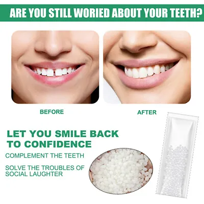 Teeth Gap Teeth Glue Resin FalseTeeth Temporary Tooth Repair Denture Make Up • £2.60