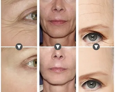 Hyaluronic Acid + Matrixyl 3000 Peptide SERUM Face Eye Anti-Aging Wrinkle Serum • $14.99