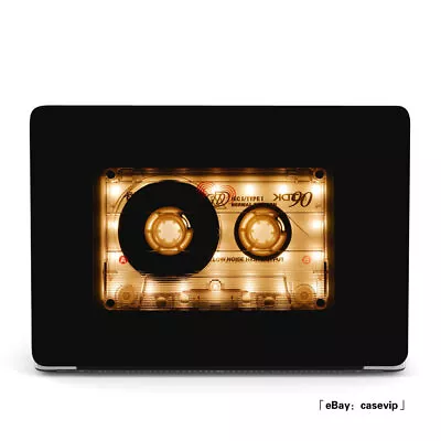 Nostalgic Cassette Tape Matte Case For Macbook M2 Air 13 11 12 Pro 16 14 15 Inch • $18.98