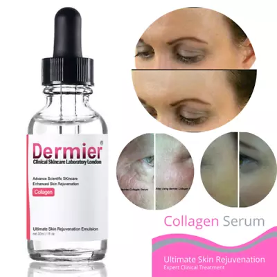 100% Pure Collagen Serum Natural Anti Wrinkle Ageing Face Care Derma Roller 30ml • $17.41