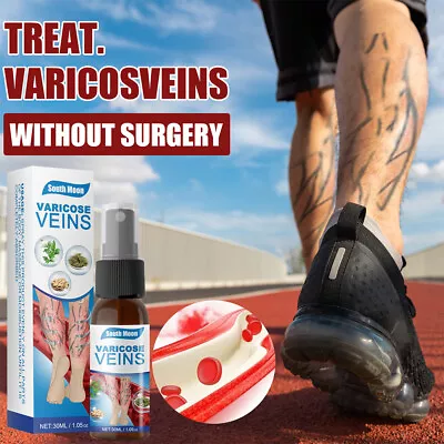 Varicose Veins Cream Relief Phlebitis Angiitis Varices Inflammation Care Spray • $8.78