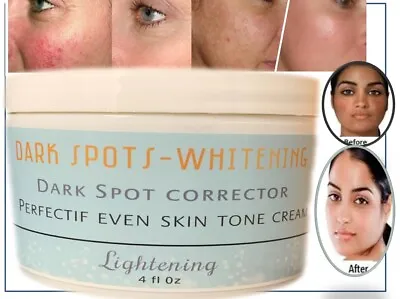 $10.30 • Buy Remove Freckle Speckle Peels Dark Spot Face Facial Skin Whitening Cream Paño 