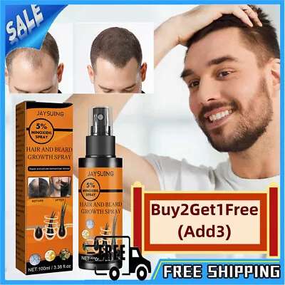 5 % Minoxidil Hair Growth Spray For Men Women 100ml Treatment Regrowth Hair UK • £6.47