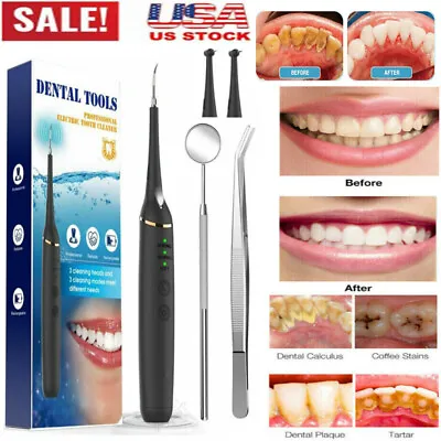 $17.65 • Buy Ultrasonic Dental Scaler Electric Tooth Cleaner Calculus Remover Teeth Whitening