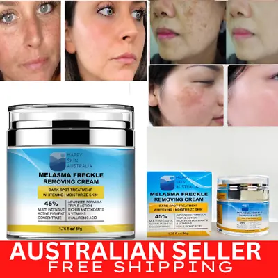 Melasma Freckle Removing Cream Whitening Skin Spots Treatment Moisturized Skin • $13.04