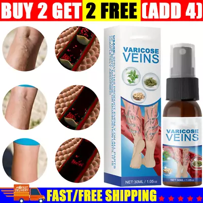 Varicose Veins Miracle Ointment Cream Gel Veinhealing Varicose Treatment Spray-- • £5.51