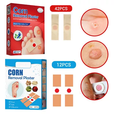 42 Pcs Foot Corn Remover Pads Plantar Wart Thorn Plaster Patch Callus Removal. • £3.71