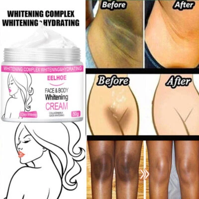 $10.96 • Buy Dark Skin Permanent Whitening Cream 3 DAY Body Bleaching Lightening Brightening
