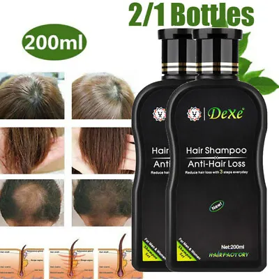 £12.95 • Buy Fast Hair Growth Shampoo For Women Men Anti Hair Loss Treatment Hair Thickening
