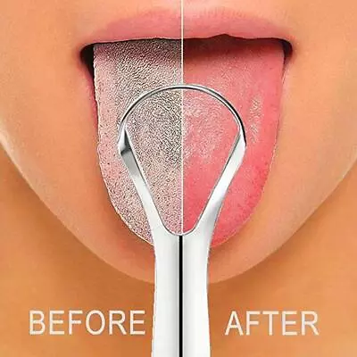 Stainless Steel Tongue Scraper Metal Tongue Cleaner Dental Care Deco • $5.42