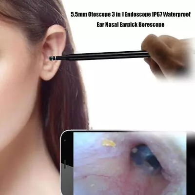 3 In 1 Ear Cleaning Endoscope Camera Ear Picker Visual Ear Mouth Nose Otoscope • $15.69