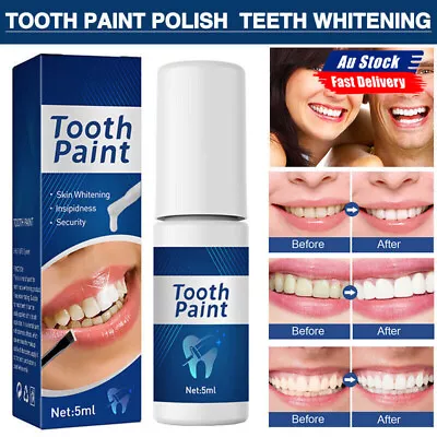 Teeth Whitening Gel Paint On Teeth Instant White  Corrector Serum Teeth Colour • $9.66