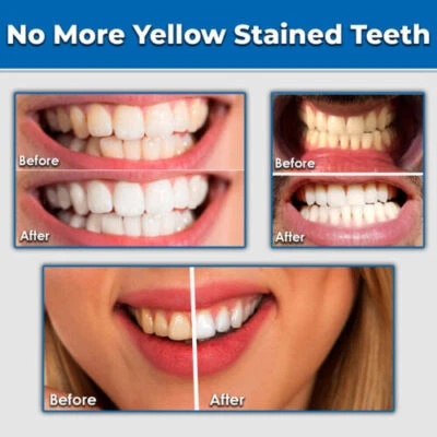 $17.99 • Buy #1 Clean Gel  Dental Strength  New Teeth Whitening Kit Safe Led White Tooth