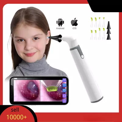 Wireless Otoscope Ear Camera Ear Scope With 6 LED Lights Support Android IPhone • $42.79