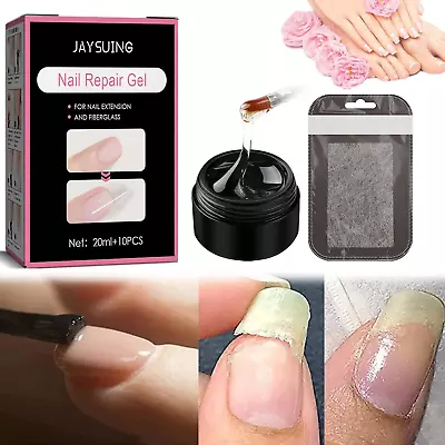 Nail Glue Instant Cracked Nail Repair Gel Nail Treatment Repair Gel Nail Kit • £9.51