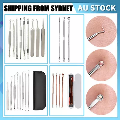 $6.72 • Buy Blackhead Remover Tool Black Spots Needles Pore Cleanser  Extractor Tool Kit