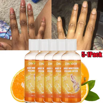 5/1XOrange Peel Peeling Lotion Face & Body Dark Skin Whitening Cream Brightening • £10.45