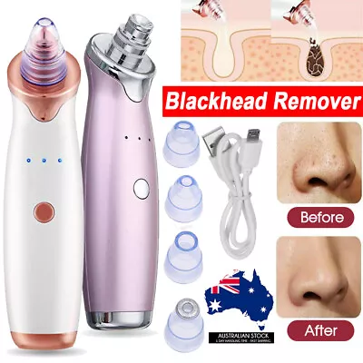 $9.99 • Buy Face Facial Pore Blackhead Remover Vacuum Suction Diamond MN