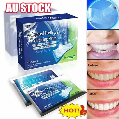 $12.37 • Buy 28 White Strip Teeth Whitening Strips Professional Advanced  Tooth Bleaching #T