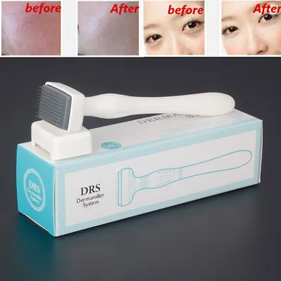 $34.31 • Buy 0.2-3mm Derma 140 Microneedle Stamp DR Roller Anti Ageing Acne Micro Needle Skin