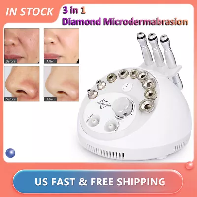 3 In 1 Diamond Microdermabrasion Dermabrasion Machine Facial Care Peel Vacuum • $48.09