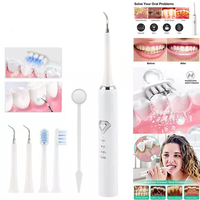 Electric Tooth Cleaner Ultrasonic Dental Scaler Tartar Plaque Calculus Remover • $18.99