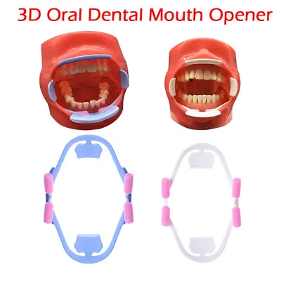 Oral Adult Lip Retractor Dental Mouth Opener Orthodontic Teeth Whitening Cheek • £5.49