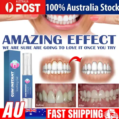 4ml Gum Instant Soothing Gel Receding Gums Therapy Inflammation Teeth Pen • $10.98