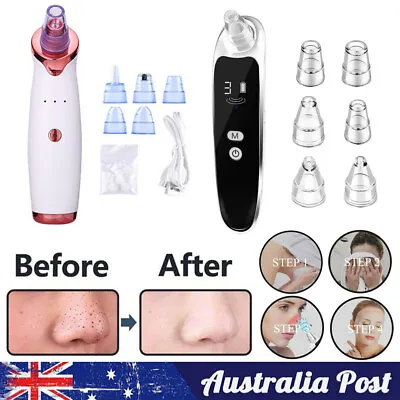 $9.87 • Buy AU Vacuum Blackhead Remover Facial Skin Pore Acne Pimple  Cleaner Machine