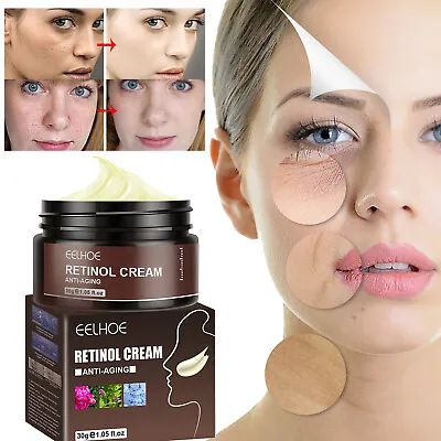 $7.99 • Buy Wrinkle Remover Instant Anti-Aging Retinol Face Cream Skin Tightening Firming US
