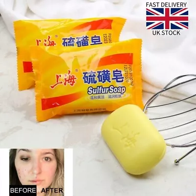 2 X Shanghai Sulfur Soap Reduce Acne Skin Itching Cleaning Skin Care Anti Fungus • £6.35