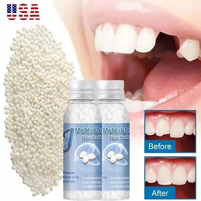 Resin False Teeth Solid Glue Temporary Tooth Repair Set Teeth And Gap Adhesive • $7.63
